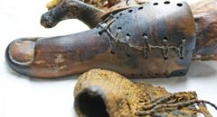 Os antigos egípcios já usavam prótese há mais de 2500 anos